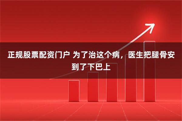 正规股票配资门户 为了治这个病，医生把腿骨安到了下巴上